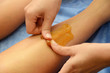 sugaring epilation