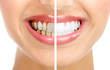 Smile.