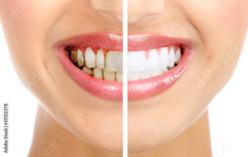 Foto: Smile. Smile.