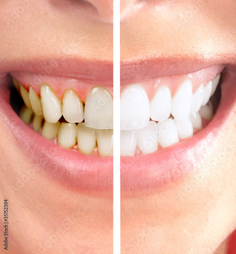 Photo: Smile. Smile.