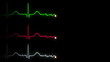 Pulse Trace Animation
