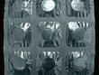 medicine tablet