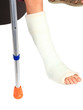 jambe dans le plâtre