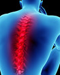Illustration: Human back pain spinal cord concept Human back pain spinal cord concept