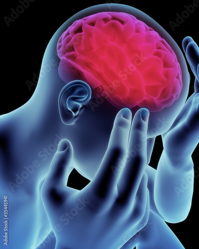 Illustration: Brain head ache, migraine, Alzheimer's or dementia Brain head ache, migraine, Alzheimer's or dementia
