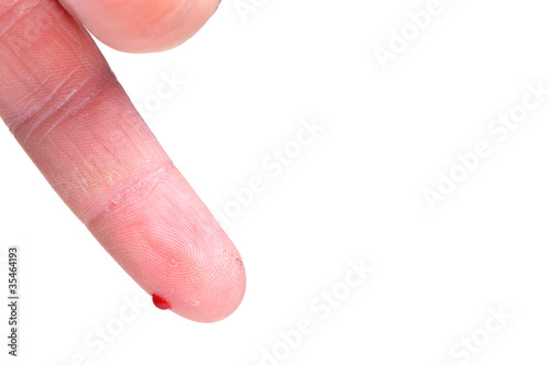 Photo: finger dripping blood on white finger dripping blood on white