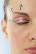 Photo: Chirurgie esthétique - Paupières Chirurgie esthétique - Paupières