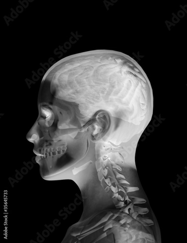 Illustration: Head X Ray Head X Ray