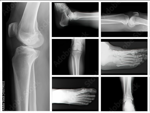 Photo: X-Ray X-Ray