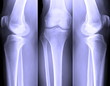 X-Ray