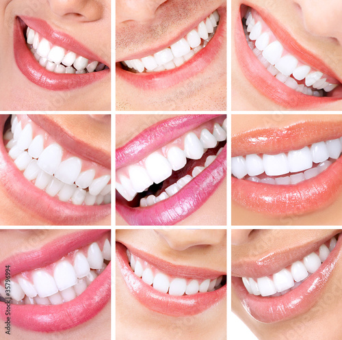 Photo: Smile and teeth. Smile and teeth.