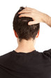 Hair loss