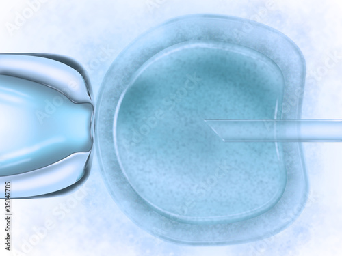Illustration: Künstliche Befruchtung - In-Vitro-Fertilisation Künstliche Befruchtung - In-Vitro-Fertilisation