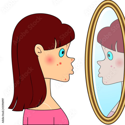 Vector: Teenager girl with acne Teenager girl with acne