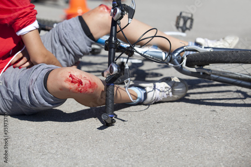 Photo: bike injuries bike injuries