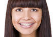 Happy teen with  braces