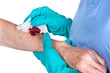 Nurse caring for wound