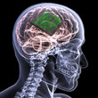 Skeleton X-Ray - Brain with CPU