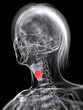 3d rendered medical illustration of larynx cancer