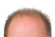 Foto: Schuetteres Haar Schuetteres Haar