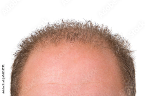 Photo: Schuetteres Haar Schuetteres Haar