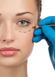 Photo: Female face before plastic surgery operation Female face before plastic surgery operation