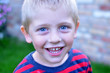 Kinderlachen