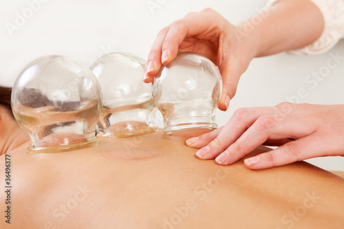 Photo: Fire Cupping Removal of Glass Globe Fire Cupping Removal of Glass Globe