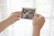 Woman examining ultrasound of fetus