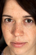 Face of a young girl with freckles Face of a young girl with freckles