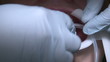 Vídeo : Orthodontist installing a dry field system Orthodontist installing a dry field system