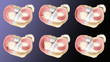 meniscus injury