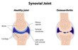 Synovial joint normal and arthritis, eps8