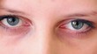 Video: Pair of eyes, nose and forehead Pair of eyes, nose and forehead