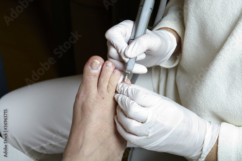 Photo: Medizinische Fußpflege - Foot care - Chiropody Medizinische Fußpflege - Foot care - Chiropody