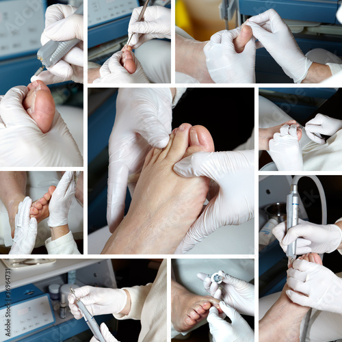 Photo: Medizinische Fußpflege - Foot care - Chiropody Medizinische Fußpflege - Foot care - Chiropody