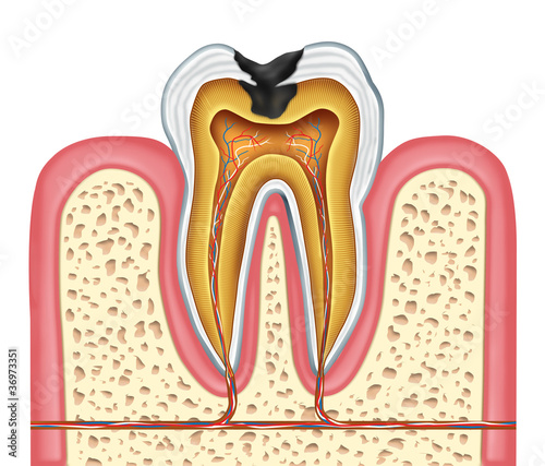 Illustration: Tooth inner anatomy of a cavity Tooth inner anatomy of a cavity