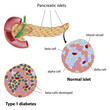Pancreatic islet normal and type 1 diabetic, eps8