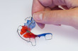 Tightening of removable dental braces