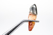 rotten tooth, root, tweezers, gold crown rotten tooth, root, tweezers, gold crown