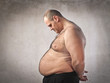 Obesity