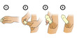 How To Use A Condom