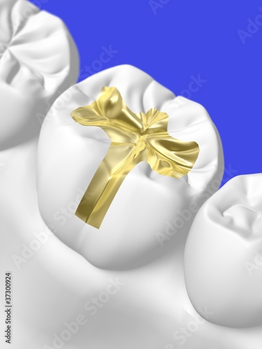 Illustration: 歯科 歯科
