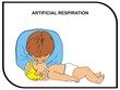 VECTOR - Artificial Respiration (Baby) VECTOR - Artificial Respiration (Baby)