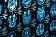 Closeup of a computer axial tomography scan (CAT scan)