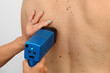 medical examination of birthmark
