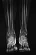 radiografia gambe e piedi