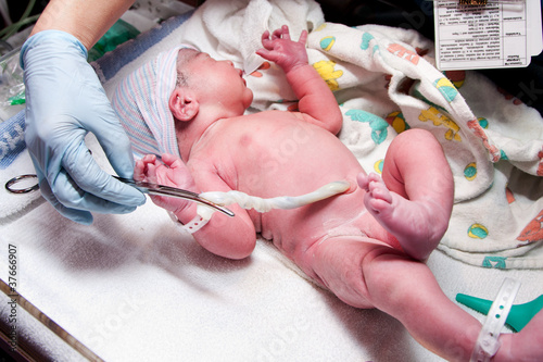 Photo: Newborn cute infant baby with umbilical cord Newborn cute infant baby with umbilical cord