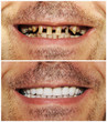 Before and after
