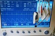Photo: Patient monitor with ECG electrodes, thermal and oximeter sensor Patient monitor with ECG electrodes, thermal and oximeter sensor